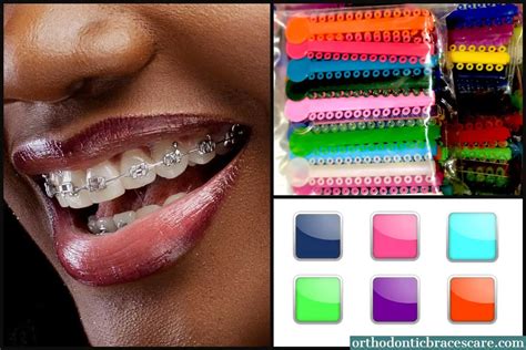 turquoise braces on dark skin